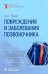 Повреждения и заболевания позвоночника