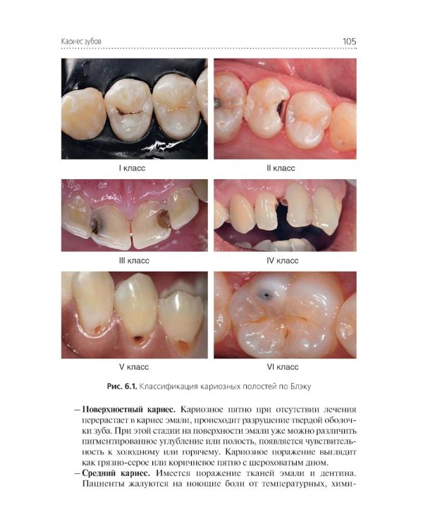 Стоматологические заболевания: Учебник
