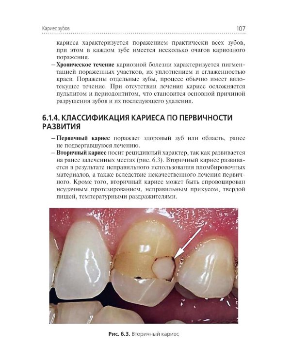 Стоматологические заболевания: Учебник