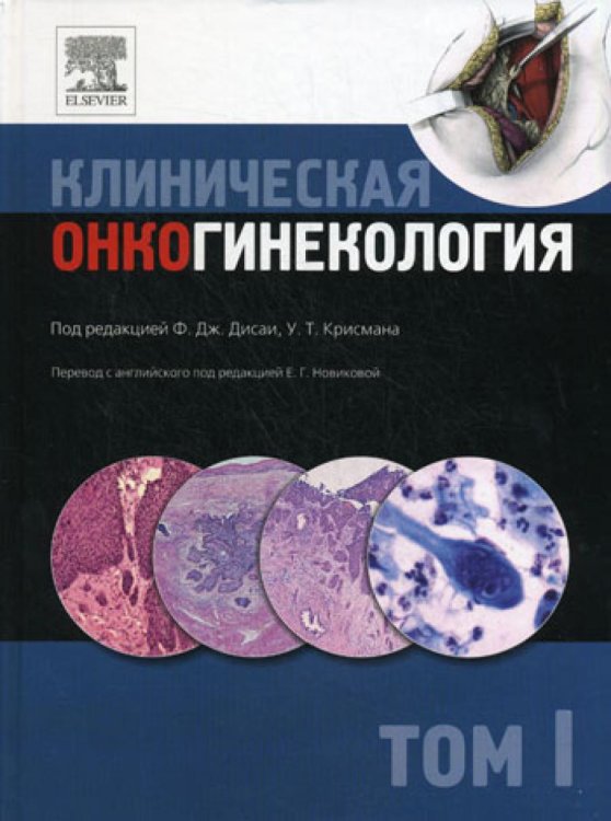 Клиническая онкогинекология. В 3 т. Т. 1 Клиническая онкогинекология. В 3 т. Т. 1