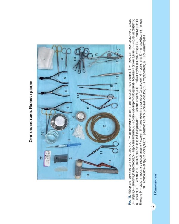 Атлас операций в оториноларингологии