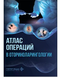 Атлас операций в оториноларингологии