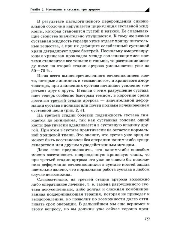 Дополнительное изображение книги «Артроз. Избавляемся от болей в суставах»