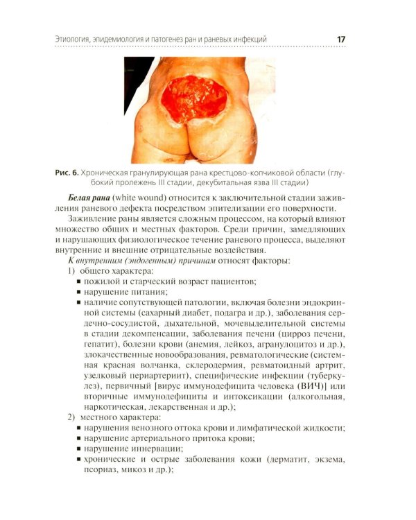 Местное лечение ран: Учебное пособие