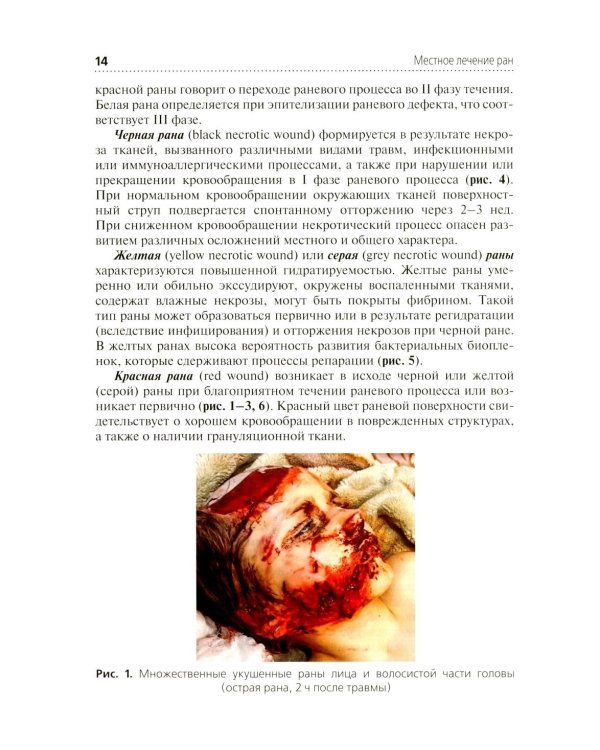 Местное лечение ран: Учебное пособие
