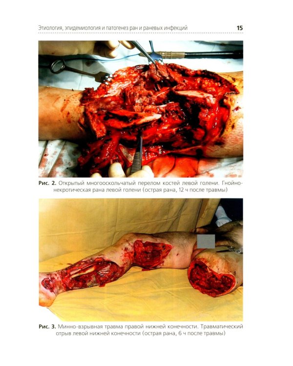 Местное лечение ран: Учебное пособие