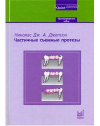 Частичные съемные протезы