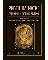 Рубец на матке: проблемы и пути их решения
