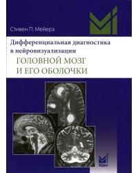 Дифференциальная диагностика в нейровизуализации. Головной мозг и его оболочки