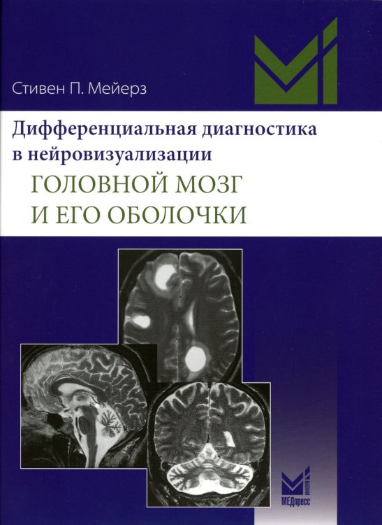 Дифференциальная диагностика в нейровизуализации. Головной мозг и его оболочки Дифференциальная диагностика в нейровизуализации. Головной мозг и его оболочки