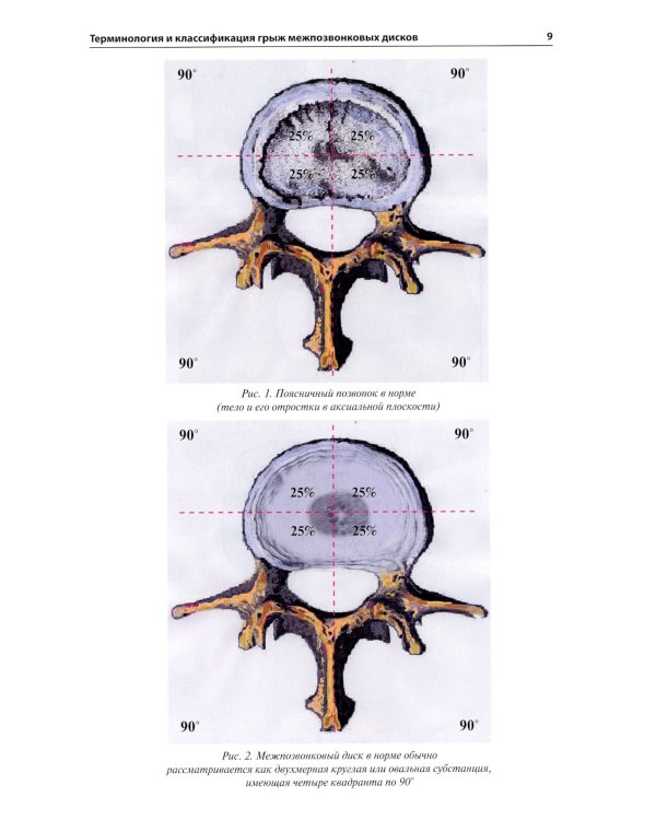 Лучевая диагностика дегенеративных заболеваний позвоночника