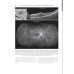 Флюоресцентная ангиография заднего полюса и периферии сетчатки: практическое руководство