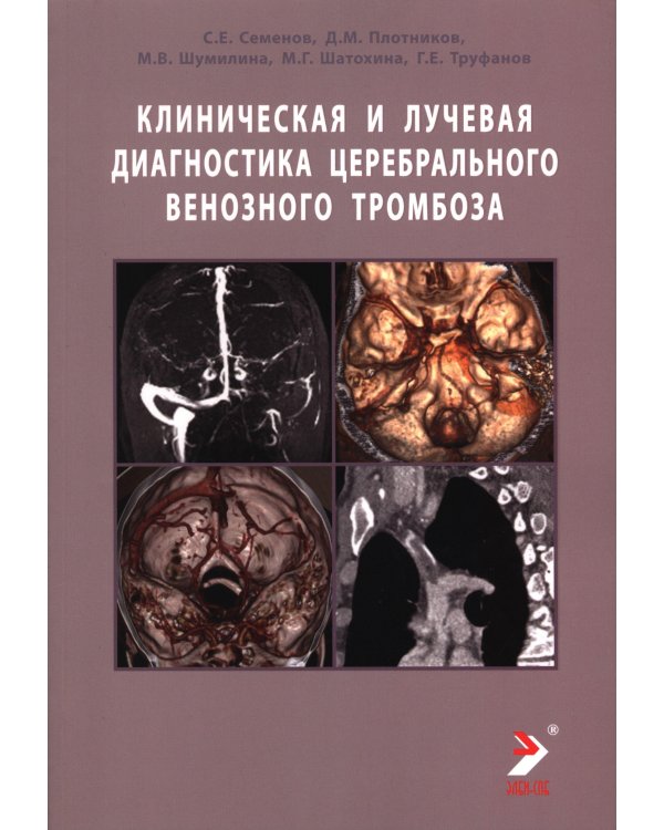 Дополнительное изображение книги «Клиническая и лучевая диагностика церебрального венозного тромбоза: Учебное пособие»