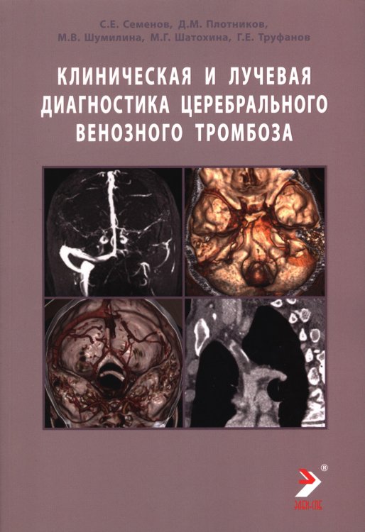 Обложка книги «Клиническая и лучевая диагностика церебрального венозного тромбоза: Учебное пособие» — Труфанов Геннадий Евгеньевич;Семенов Станислав Евгеньевич;Плотников Д.М.;Шумилина М.В., ISBN 9785907894174