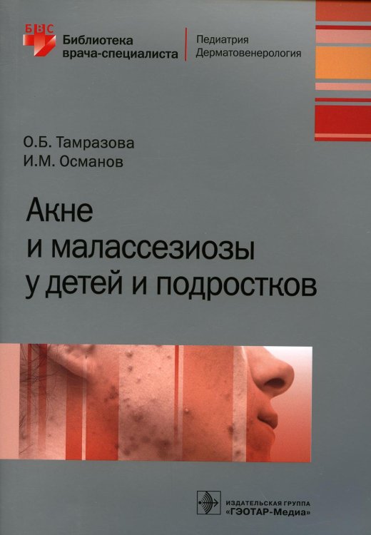 Библиотека врача-специалиста Акне и малассезиозы у детей и подростков