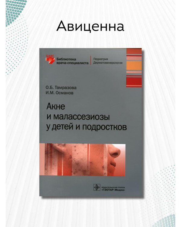 Акне и малассезиозы у детей и подростков
