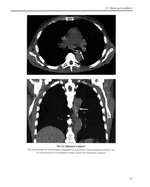 Визуализация заболеваний желудочно-кишечного тракта: Учебное пособие