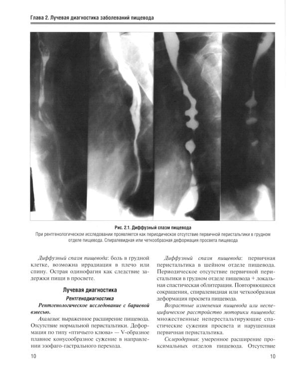 Визуализация заболеваний желудочно-кишечного тракта: Учебное пособие