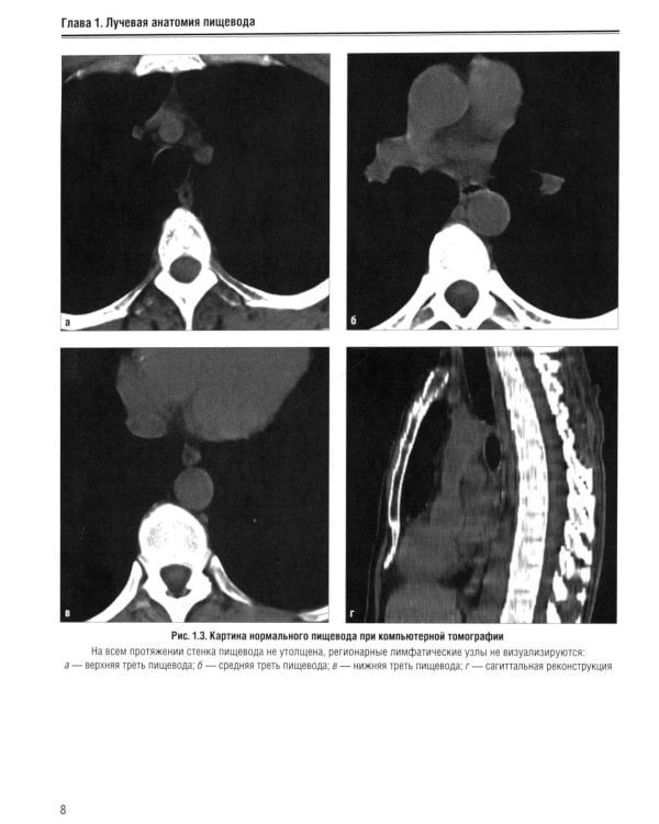 Визуализация заболеваний желудочно-кишечного тракта: Учебное пособие