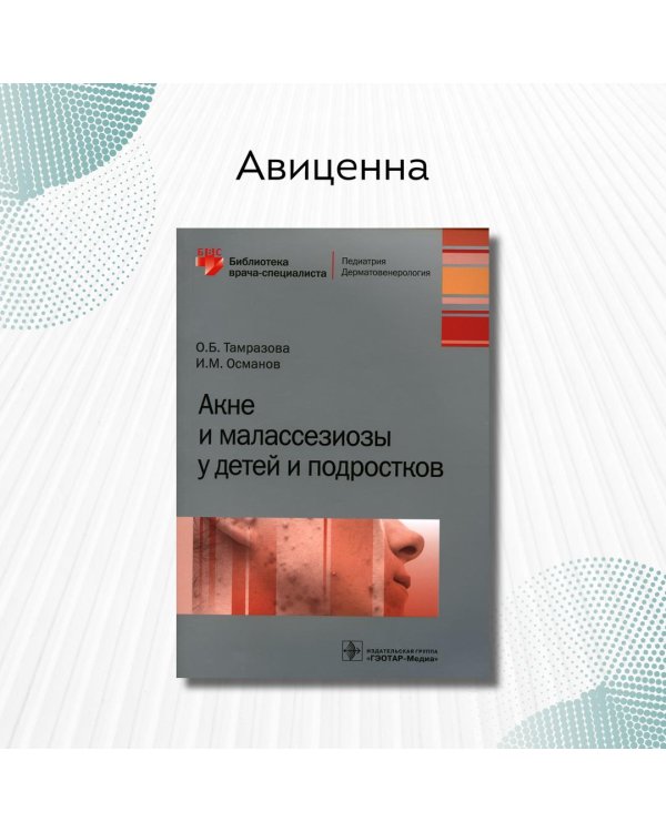 Акне и малассезиозы у детей и подростков