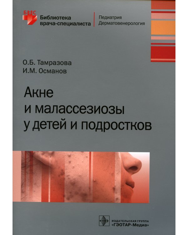 Акне и малассезиозы у детей и подростков