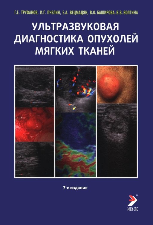 Обложка книги «Ультразвуковая диагностика опухолей мягких тканей. 7-е изд» — Труфанов Геннадий Евгеньевич;Пчелин Игорь Георгиевичч, ISBN 9785604426272