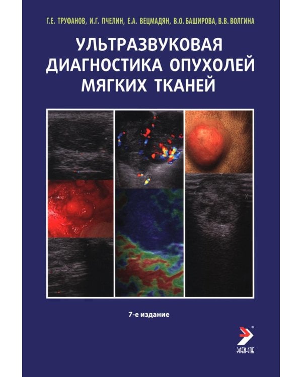 Дополнительное изображение книги «Ультразвуковая диагностика опухолей мягких тканей. 7-е изд»