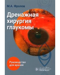 Дренажная хирургия глаукомы: руководство для врачей