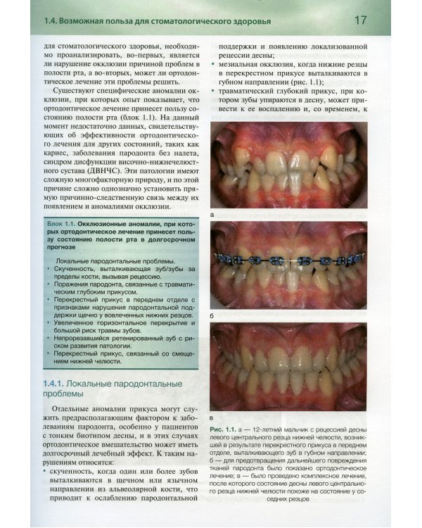 Ортодонтия. Базовое руководство