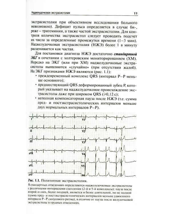 Как лечить аритмии. Нарушения ритма и проводимости в клинической практике. 11-е изд