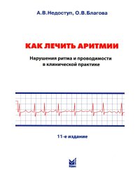 Как лечить аритмии. Нарушения ритма и проводимости в клинической практике. 11-е изд