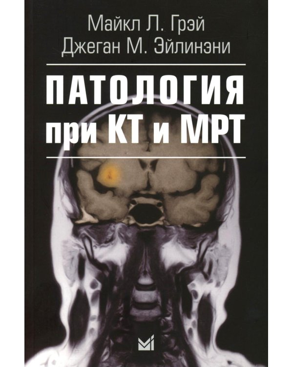 Патология при КТ и МРТ. 3-е изд