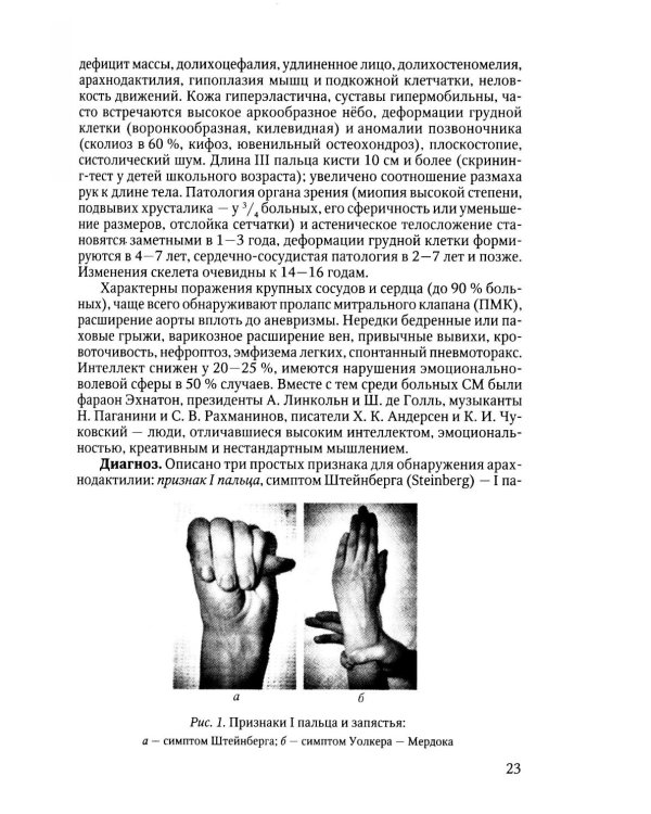 Наследственные нарушения соединительной ткани как конституции. 3-е изд., испр. и доп