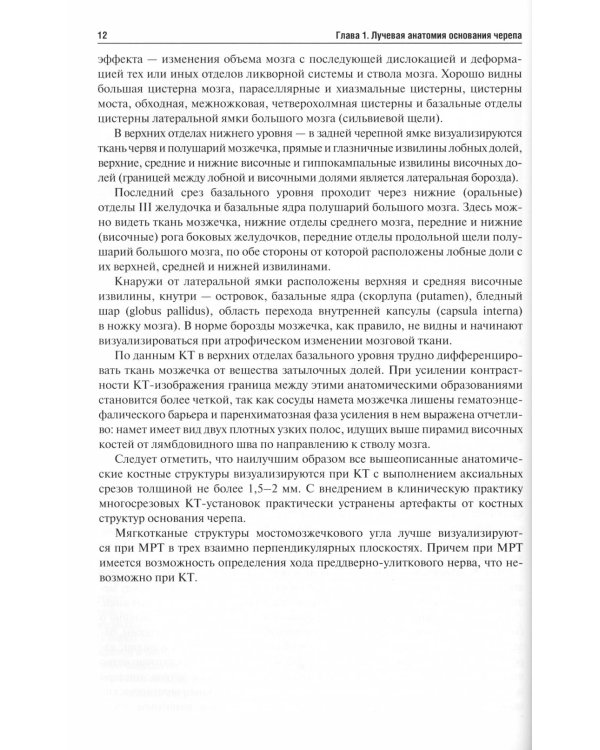 Лучевая диагностика заболеваний оснований черепа и мостмозжечкового угла: Учебное пособие