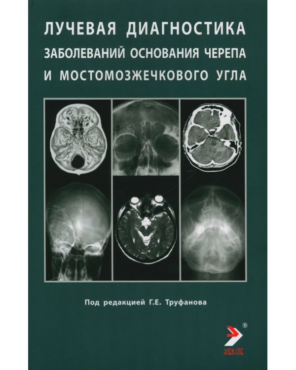 Лучевая диагностика заболеваний оснований черепа и мостмозжечкового угла: Учебное пособие