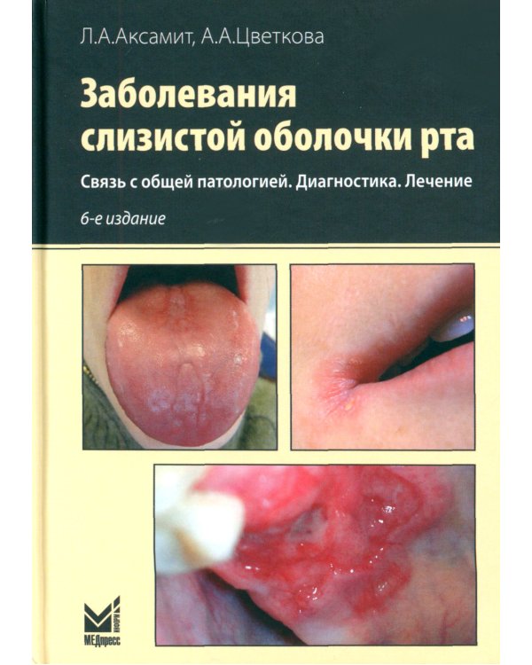 Заболевания слизистой оболочки рта. Связь с общей патологией. Диагностика. Лечение