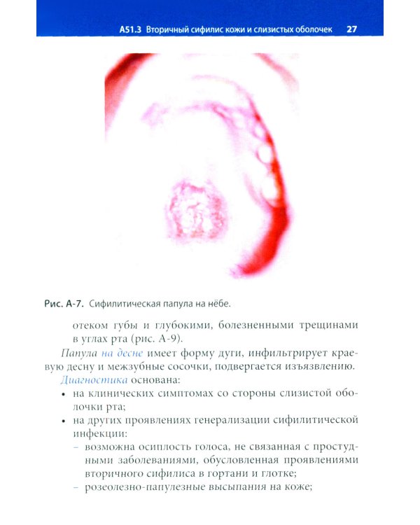 Заболевания слизистой оболочки рта. Связь с общей патологией. Диагностика. Лечение
