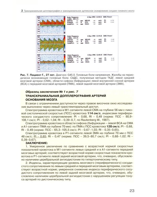 Дуплексное сканирование внутричерепных отделов брахиоцефальных артерий и вен. Учебное пособие
