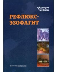Рефлюкс-эзофагит