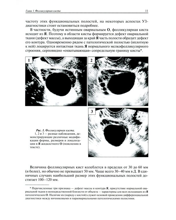 Ультразвуковая симптоматика и дифференциальная диагностика кист и опухолей яичников. 2-е изд