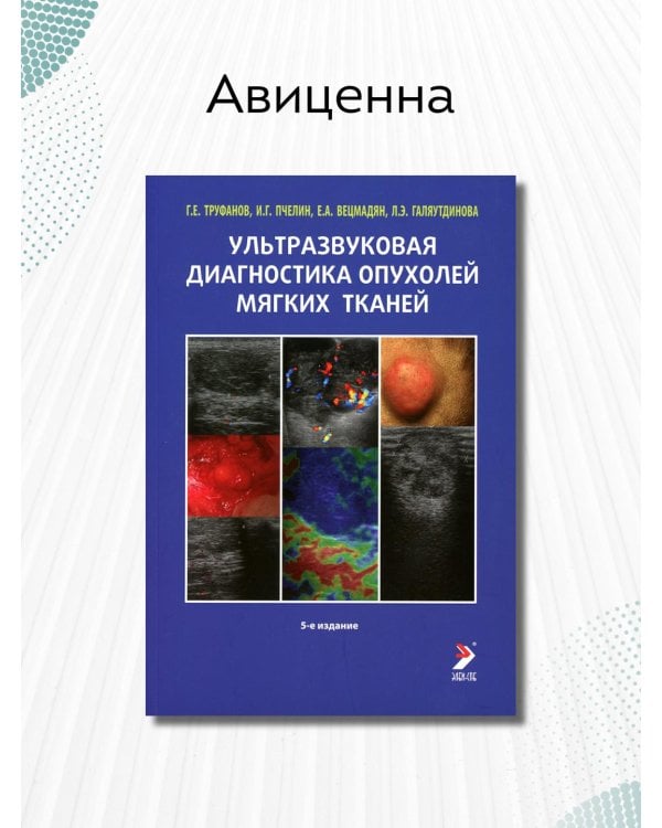Ультразвуковая диагностика опухолей мягких тканей