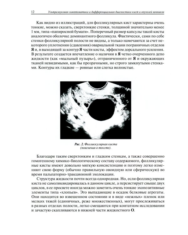 Ультразвуковая симптоматика и дифференциальная диагностика кист и опухолей яичников. 2-е изд