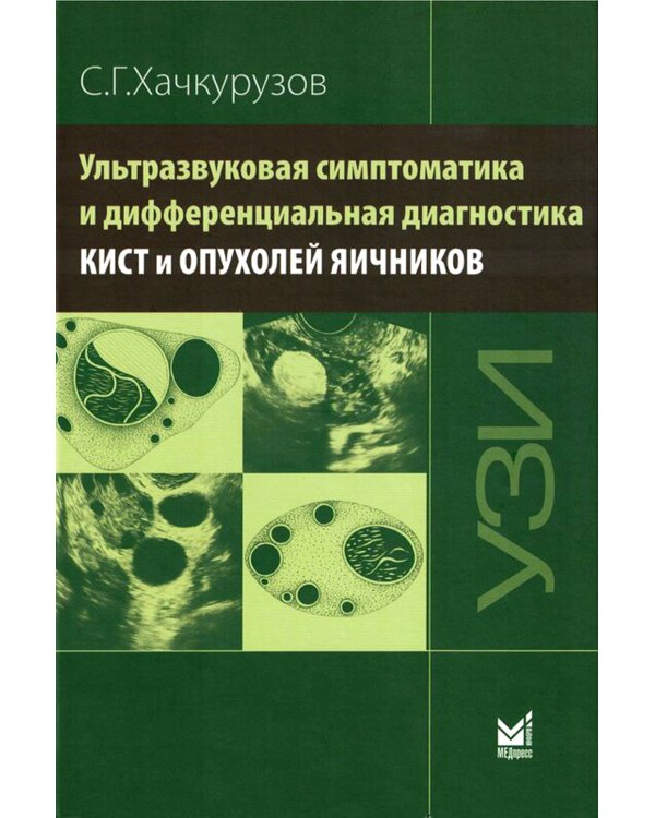 Ультразвуковая симптоматика и дифференциальная диагностика кист и опухолей яичников. 2-е изд