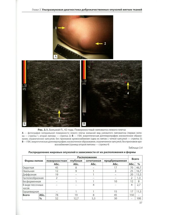 Ультразвуковая диагностика опухолей мягких тканей. 6-е изд