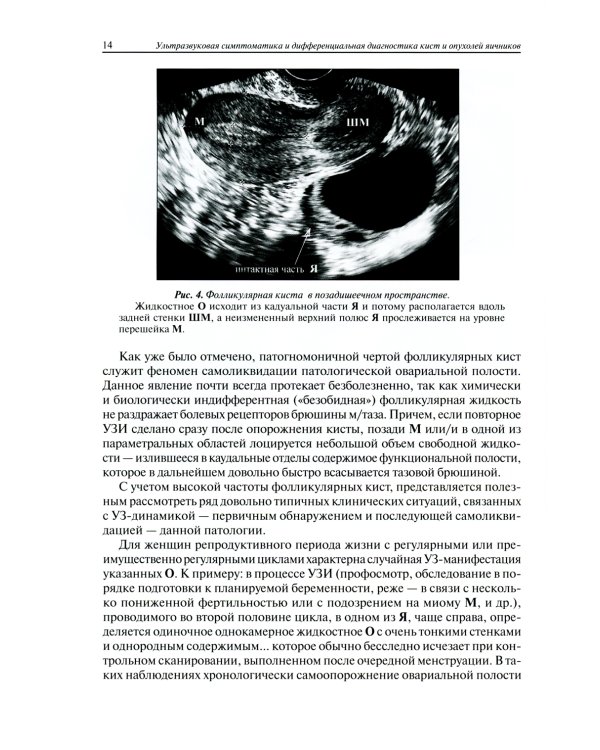 Ультразвуковая симптоматика и дифференциальная диагностика кист и опухолей яичников. 2-е изд