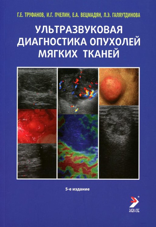 Ультразвуковая диагностика опухолей мягких тканей. 6-е изд Ультразвуковая диагностика опухолей мягких тканей. 6-е изд