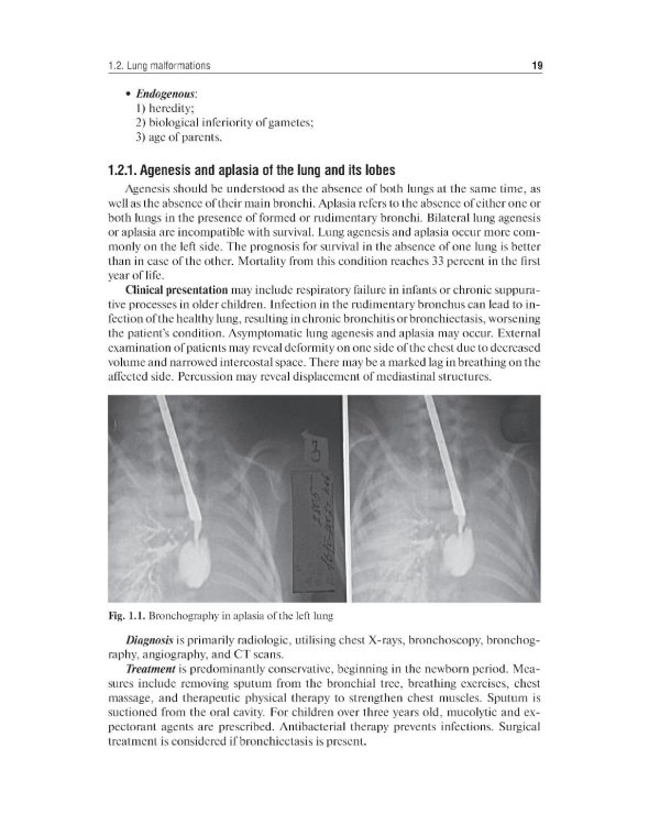 Pediatric surgery : textbook
