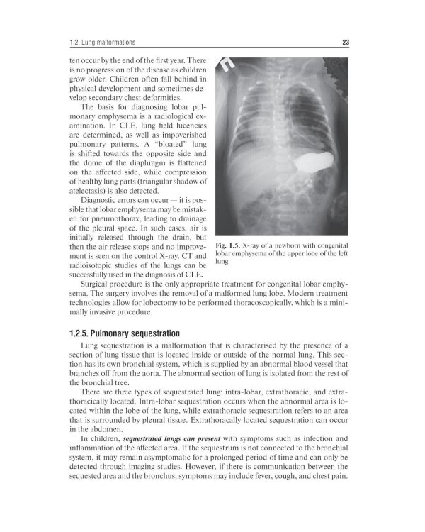 Pediatric surgery : textbook