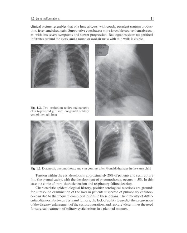 Pediatric surgery : textbook