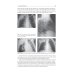 Pediatric surgery : textbook